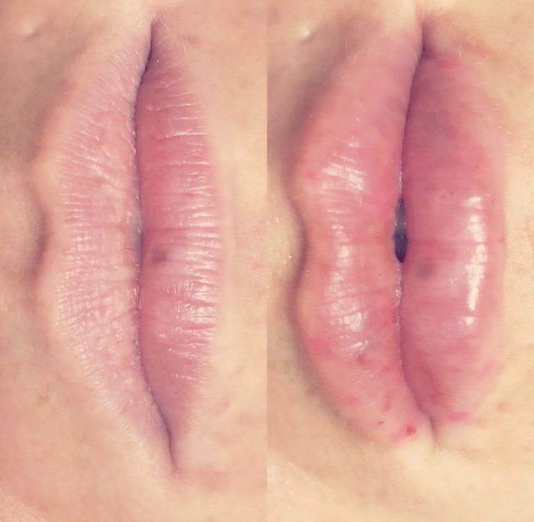 Perfect 10 Spa 4 IMG 6675 768x751